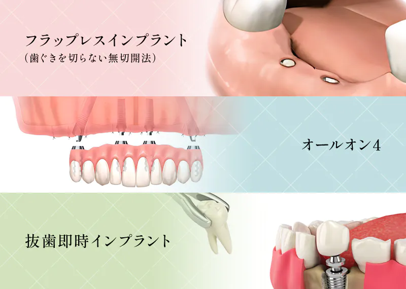 1日で歯が入る即日・即時インプラント治療に対応