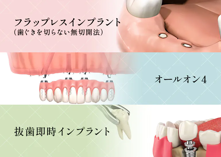 1日で歯が入る即日・即時インプラント治療に対応