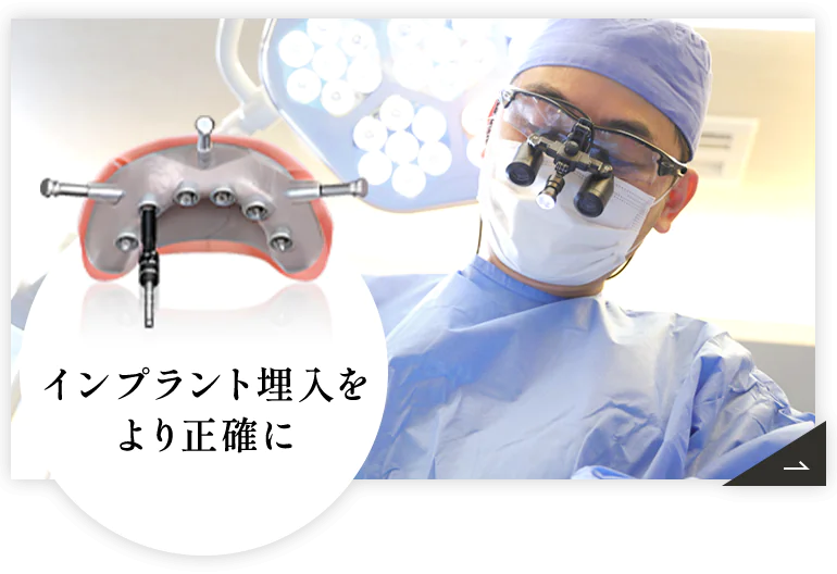 安全・確実な治療のためのガイドサージェリー