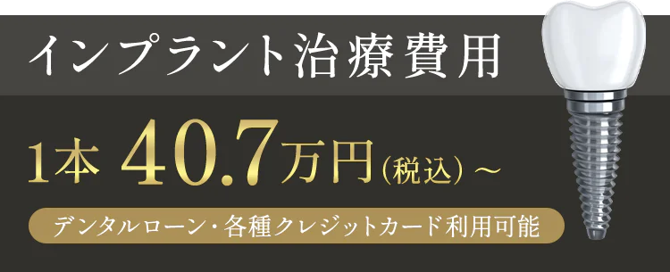 インプラント治療費用1本 40.7万円（税込）～　デンタルローン・各種クレジットカード利用可能